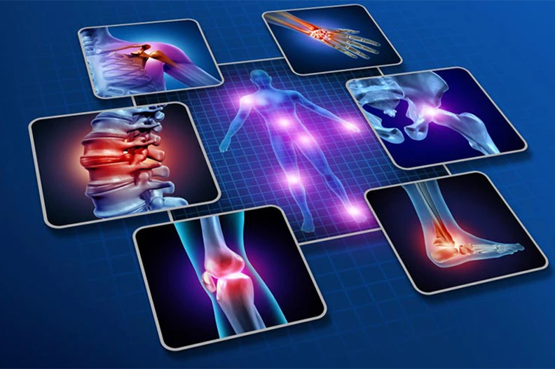 Diagnóstico precoce pode melhorar a qualidade de vida de quem tem fibromialgia